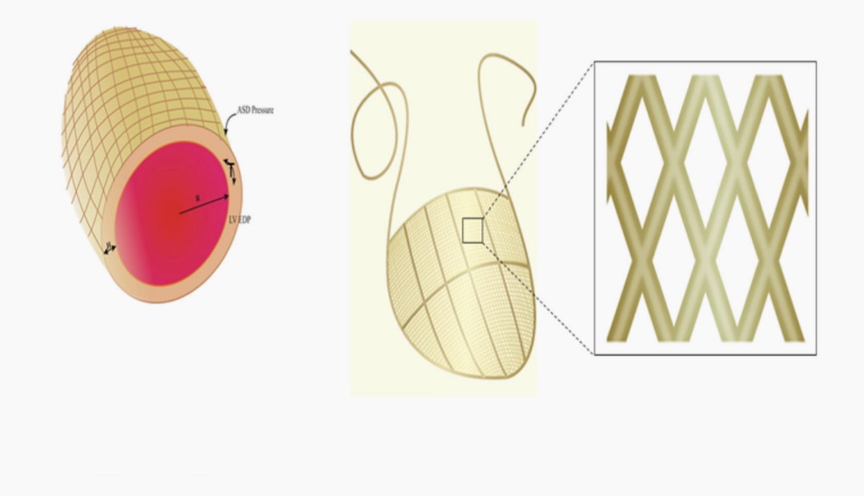patent.jpg